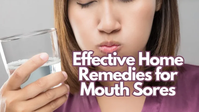 Effective Home Remedies for Mouth Sores