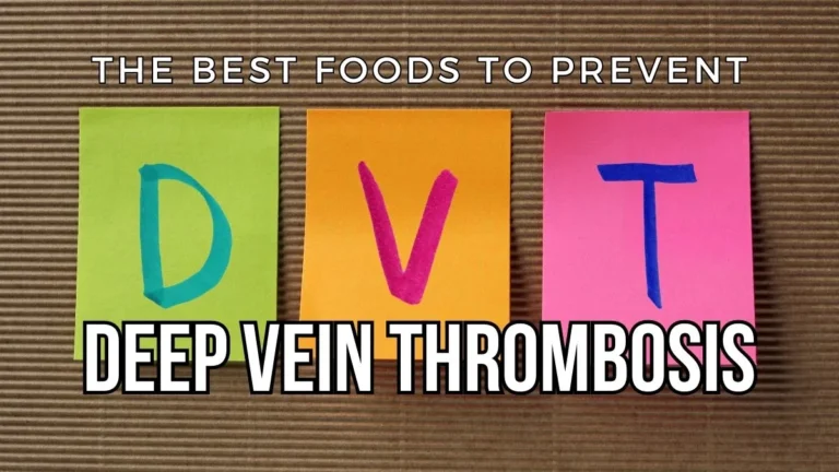 The Best Foods To Prevent DVT (Deep Vein Thrombosis)